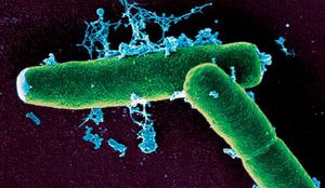 300px-Bacillus_anthracis_1